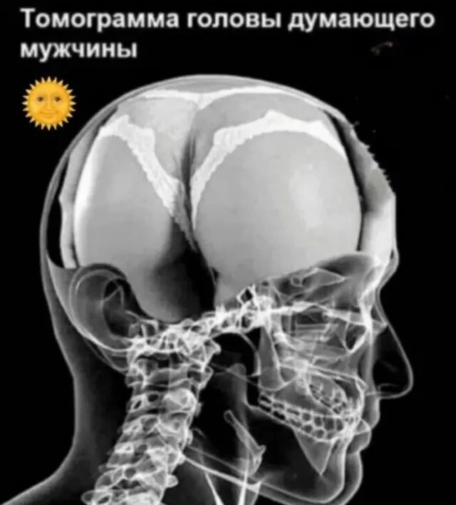 Томограмма головы думающего мужчины