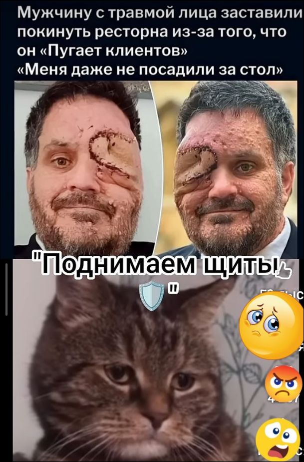 Мужчину с травмой лица заставили покинуть ресторан из-за того, что он «Пугает клиентов» «Меня даже не посадили за стол» «Поднимаем щиты!»