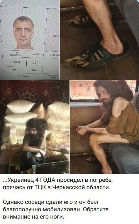 Украинец 4 ГОДА просидел в погребе, прячась от ТЦК в Черкасской области. Однако соседи сдали его и он был благополучно мобилизован. Обратите внимание на его ноги.