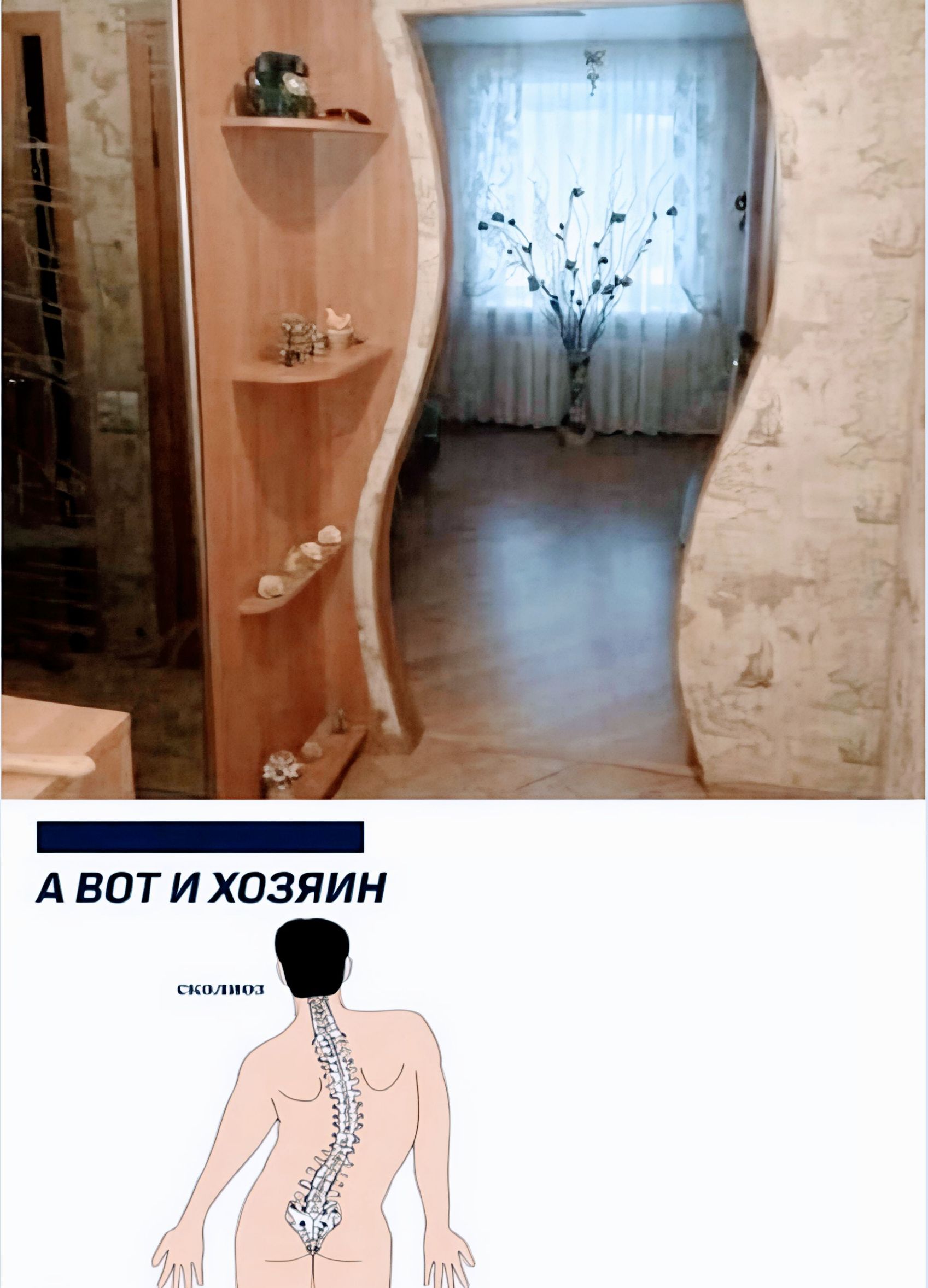 А ВОТ И ХОЗЯИН сколиоз