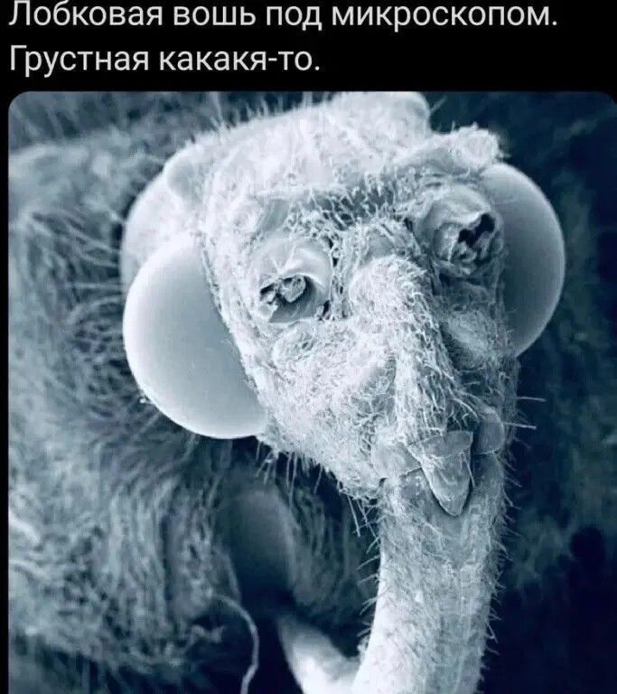 Лобковая вошь под микроскопом. Грустная какая-то.