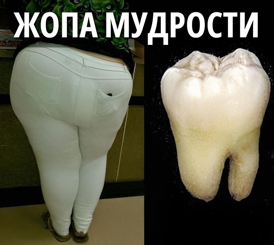 ЖОПА МУДРОСТИ
