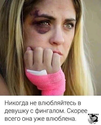 Никогда не влюбляйтесь в девушку с фингалом. Скорее всего она уже влюблена.