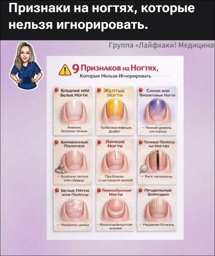 Признаки на ногтях, которые нельзя игнорировать. Группа «Лайфхаки! Медицина» 9 Признаков на Ногтях, Которые Нельзя Игнорировать Бледные или Белые Ногти: Анемия, Болезни печени. Желтые Ногти: Грибковая инфекция, Диабет. Синие или Фиолетовые Ногти: Низкий уровень кислорода. Барабанные Палочки: Болезни легких или сердца. Ломкие Ногти: Проблемы со
