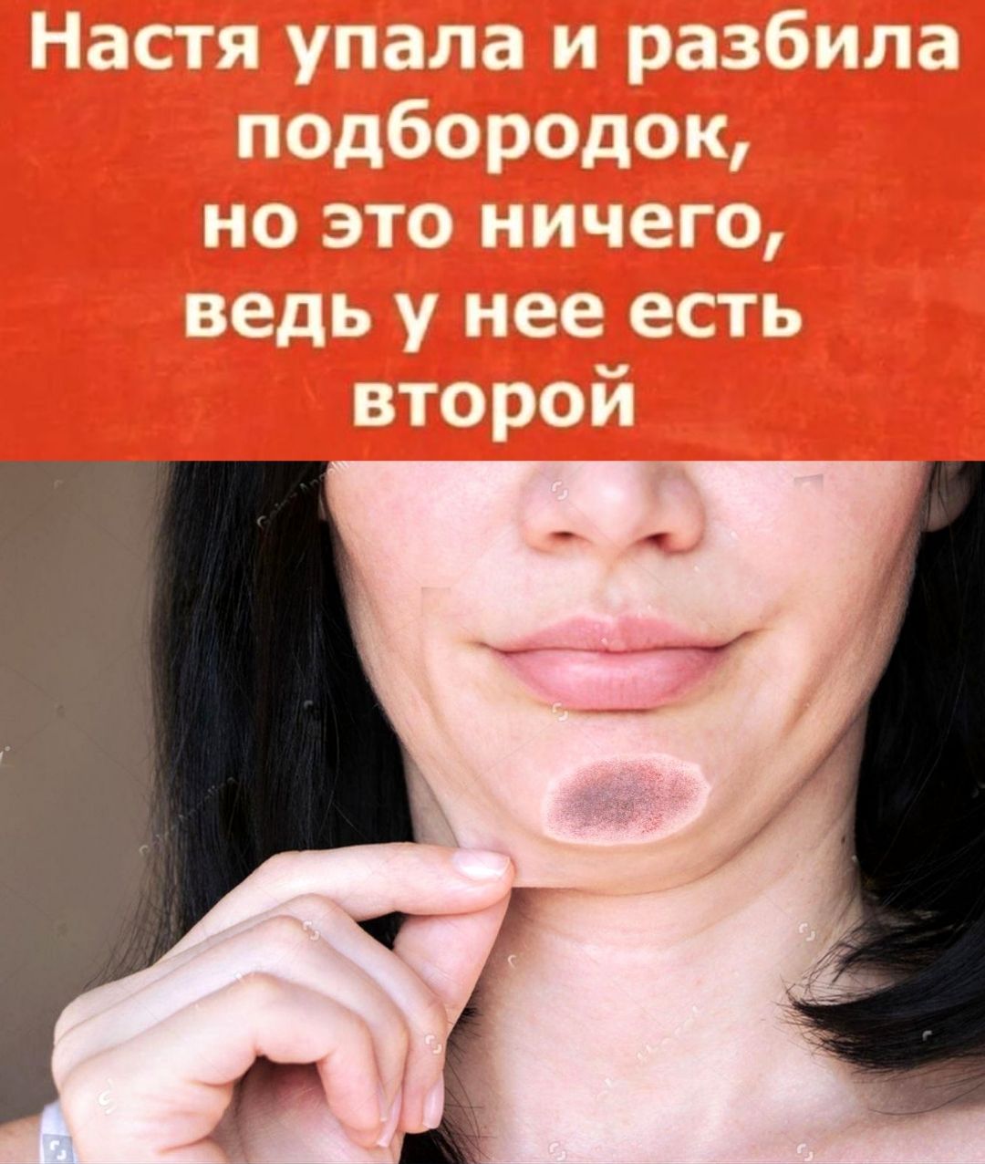 Настя упала и разбила подбородок, но это ничего, ведь у нее есть второй