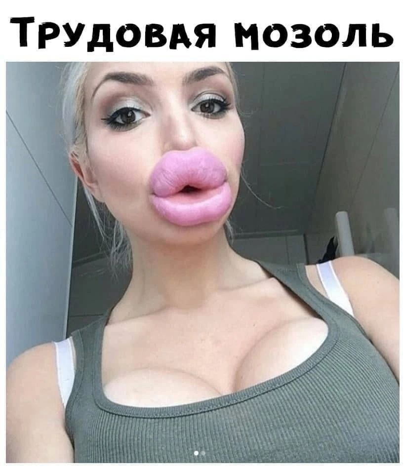 Трудовая мозоль