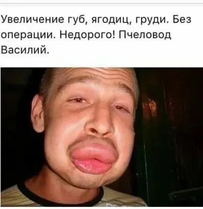 Увеличение губ, ягодиц, груди. Без операции. Недорого! Пчеловод Василий.