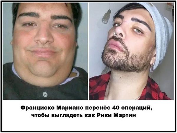 Франциско Мариано перенёс 40 операций, чтобы выглядеть как Рики Мартин