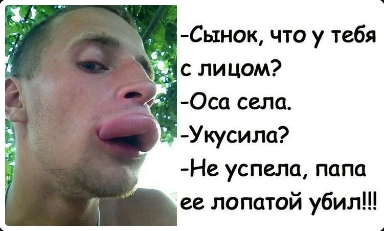 -Сынок, что у тебя с лицом? -Оса села. -Укусила? -Не успела, папа ее лопатой убил!!!
