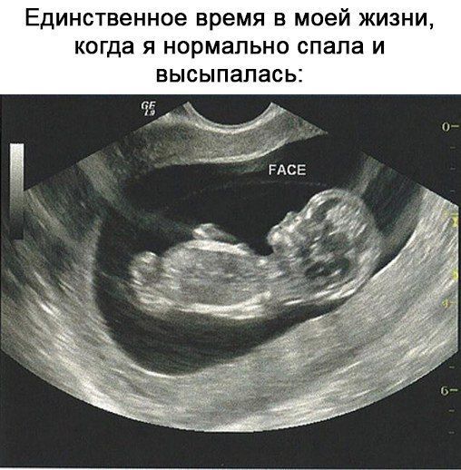 Единственное время в моей жизни, когда я нормально спала и высыпалась: FACE