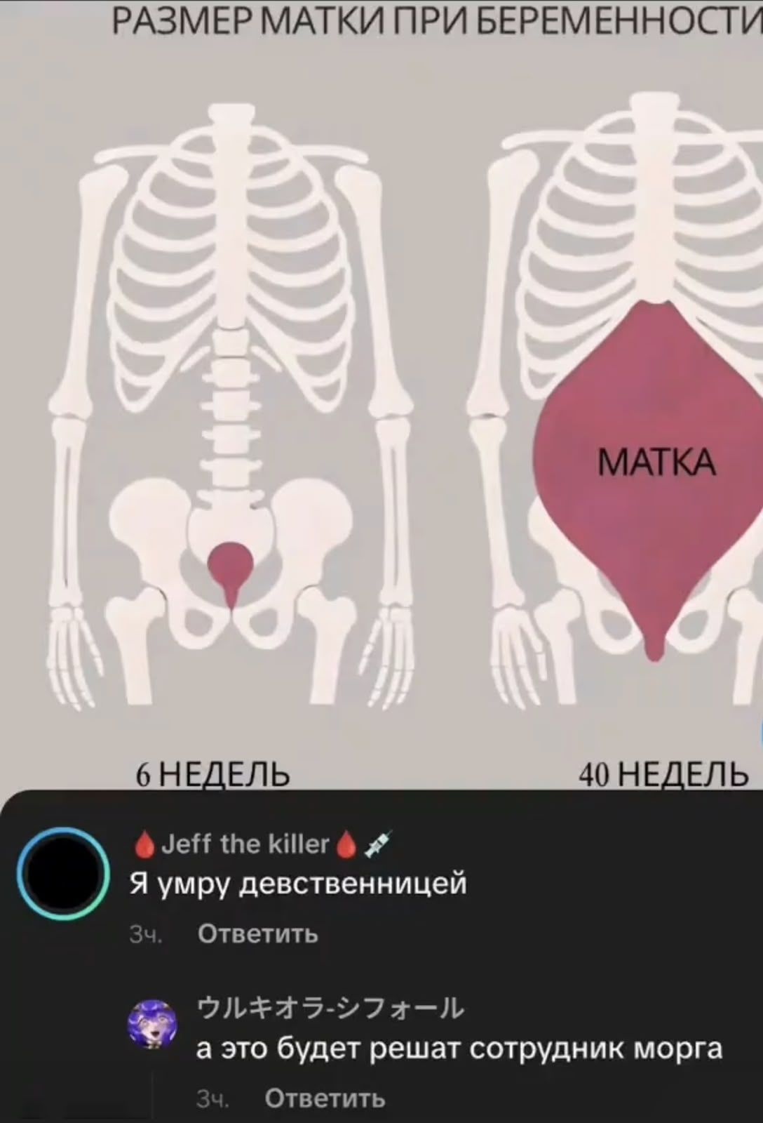 РАЗМЕР МАТКИ ПРИ БЕРЕМЕННОСТИ 6 НЕДЕЛЬ 40 НЕДЕЛЬ МАТКА Jeff the killer Я умру девственницей а это будет решать сотрудник морга