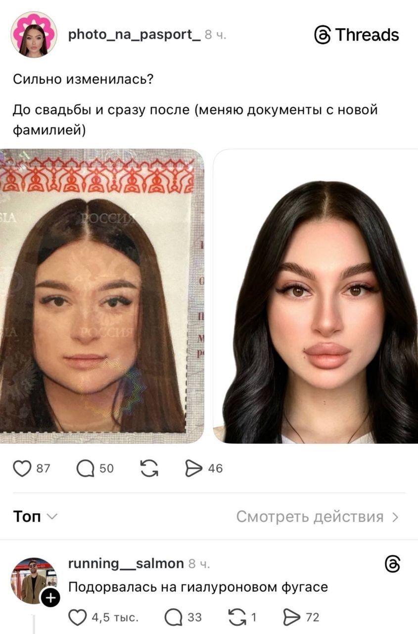 photo_na_pasport_ 8 ч. Threads Сильно изменилась? До свадьбы и сразу после (меняю документы с новой фамилией) РОССИЯ running__salmon 8 ч. Подорвалась на гиалуроновом фугасе
