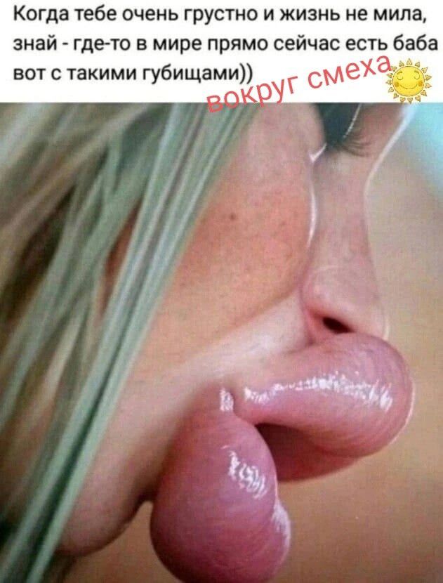 Когда тебе очень грустно и жизнь не мила, знай - где-то в мире прямо сейчас есть баба вот с такими губищами)) вокруг смеха