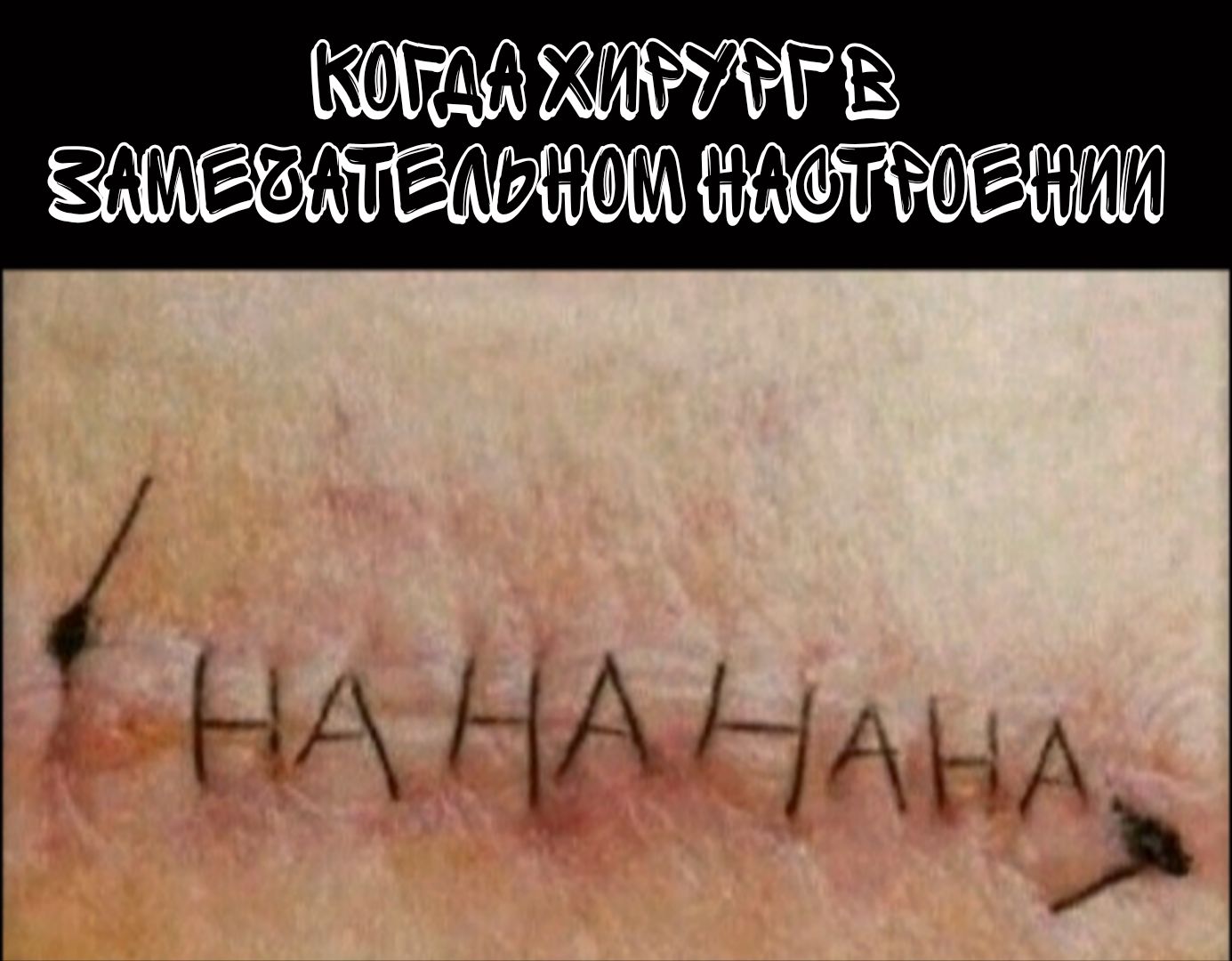 КОГДА ХИРУРГ В ЗАМЕЧАТЕЛЬНОМ НАСТРОЕНИИ HAHAHAHA