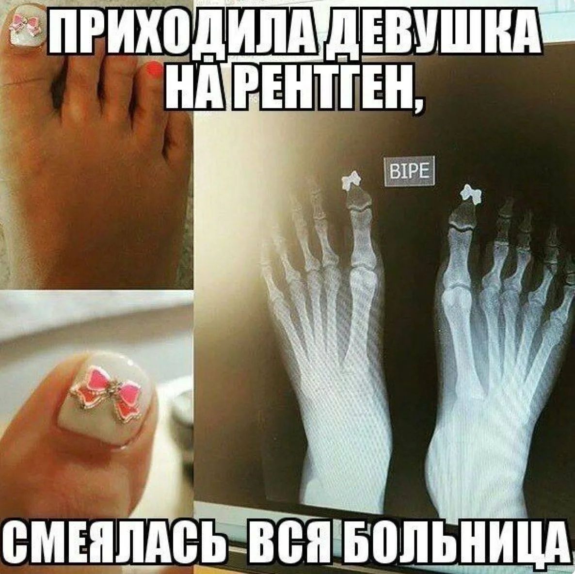 ПРИХОДИЛА ДЕВУШКА НА РЕНТГЕН, СМЕЯЛАСЬ ВСЯ БОЛЬНИЦА