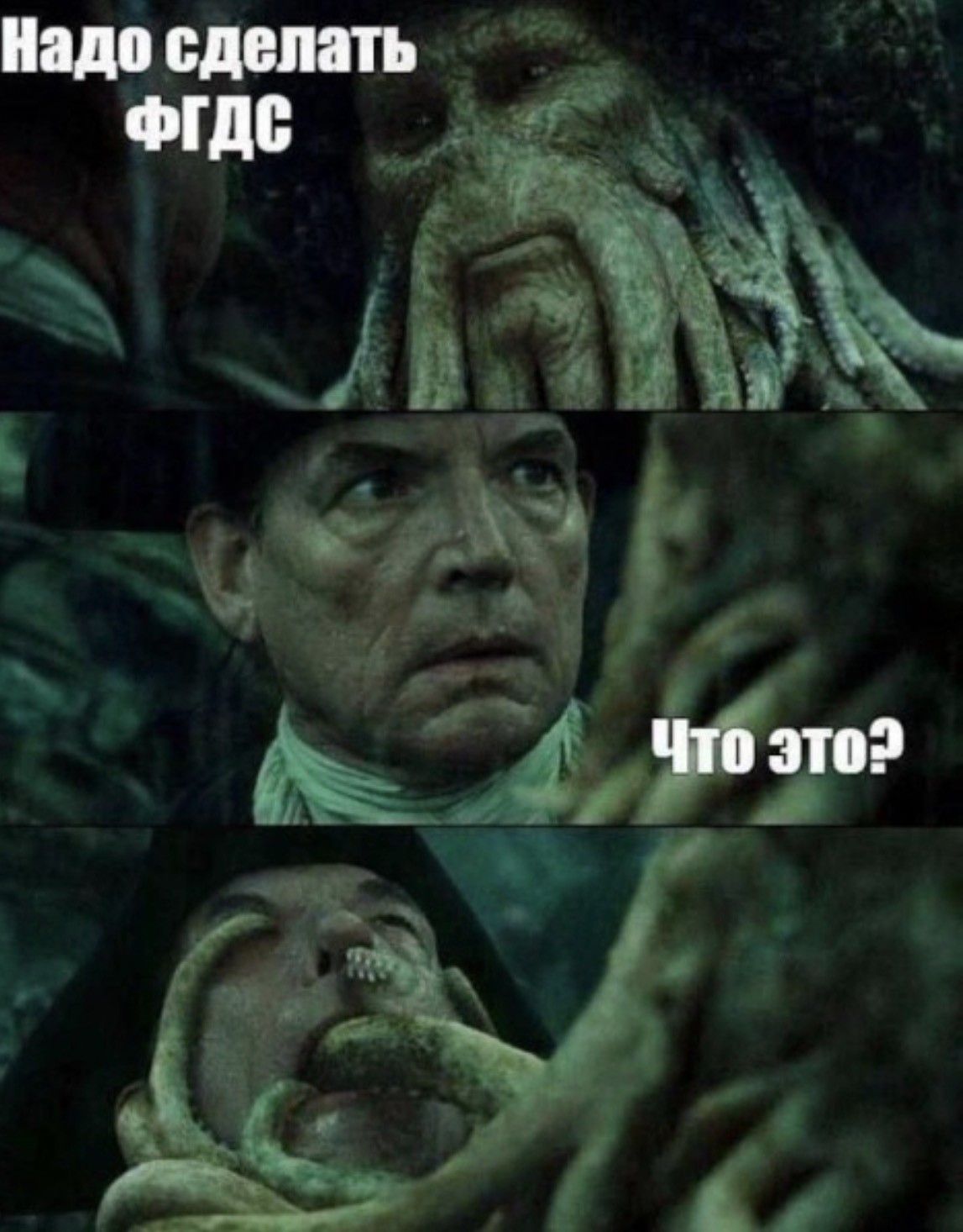 Надо сделать ФГДС Что это?