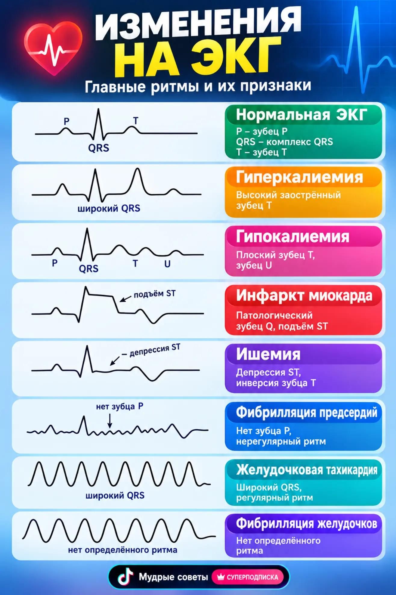 ИЗМЕНЕНИЯ НА ЭКГ Главные ритмы и их признаки Нормальная ЭКГ Гиперкалиемия Гипокалиемия Инфаркт миокарда Ишемия Фибрилляция предсердий Желудочковая тахикардия Фибрилляция желудочков Мудрые советы суперподписка