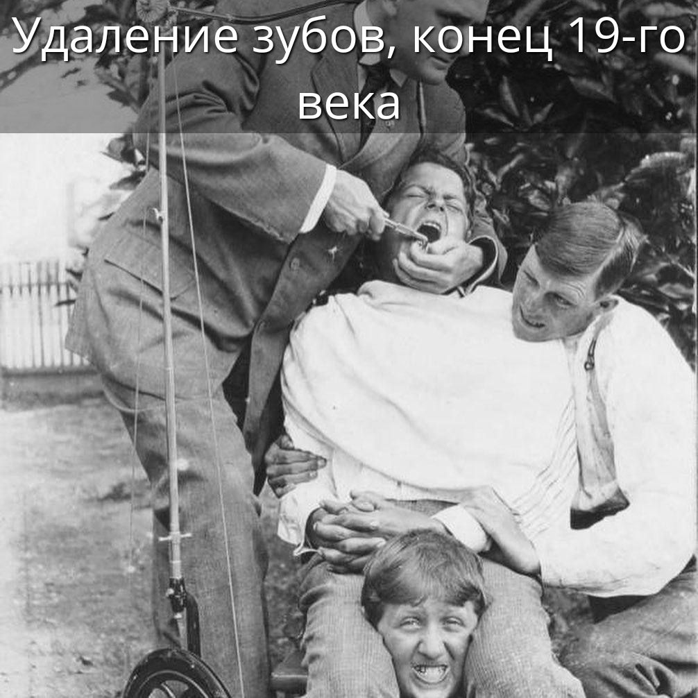 Удаление зубов, конец 19-го века