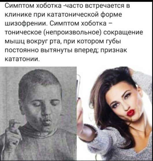 Симптом хоботка - часто встречается в клинике при кататонической форме шизофрении. Симптом хоботка – тоническое (непроизвольное) сокращение мышц вокруг рта, при котором губы постоянно вытянуты вперед; признак кататонии.