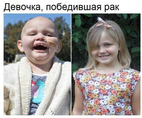 Девочка победившая рак