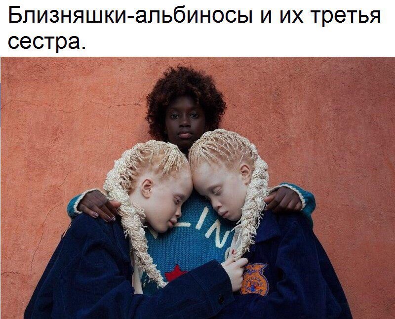 Близняшки апьбиносы и их третья сестра