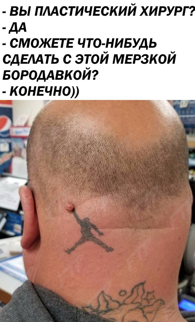 ВЫ ПЛАСТИЧЕСКИЙ ХИРУРГ ДА СМОЖЕТЕ ЧТО НИБУДЬ СДЕЛАТЬ С ЭТОИ МЕРЗКОИ БОРОДАВКОИ КОНЕЧНО