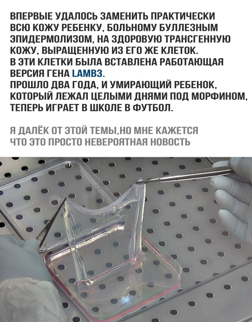 ВПЕРВЫЕ УДАЛОСЬ ЗАМЕНИТЬ ПРАКТИЧЕСКИ ВСЮ КОЖУ РЕБЕНКУ БОЛЬНОМУ БУЛЛЕЗНЫМ ЭПИДЕРМОЛИЗОМ НА ЗДОРОВУЮ ТРАНСГЕННУЮ КОЖУ ВЫРАЩЕННУЮ ИЗ ЕГО ЖЕ КЛЕТОК В ЭТИ КЛЕТКИ БЫЛА ВСТАВЛЕНА РАБОТАЮЩАЯ ВЕРСИЯ ГЕНА АМВЗ ПРОШЛО ДВА ГОДА И УМИРАЮЩИИ РЕБЕНОК КОТОРЫЙ ЛЕЖАЛ ЦЕЛЫМИ дНЯМИ ПОД МОРФИНОМ ТЕПЕРЬ ИГРАЕТ В ШКОЛЕ В ФУТБОЛ Я ДАЛЁК ОТ ЭТОЙ ТЕМЬНО МНЕ КАЖЕТСЯ ЧТО ЭТО ПРОСТО НЕВЕРОЯТНАЯ НОВОСТЬ