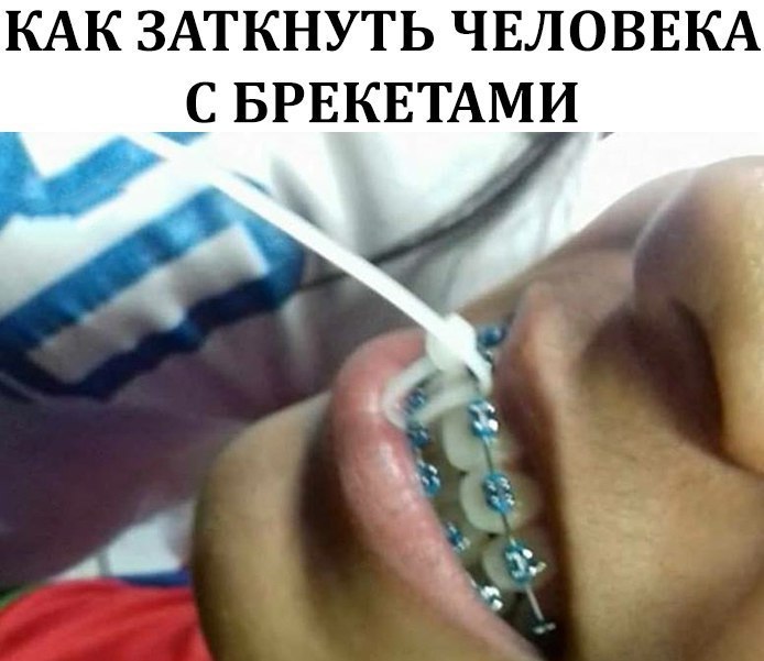 КАК ЗАТКНУТЬ ЧЕЛОВЕКА С БРЕКЕТАМИ
