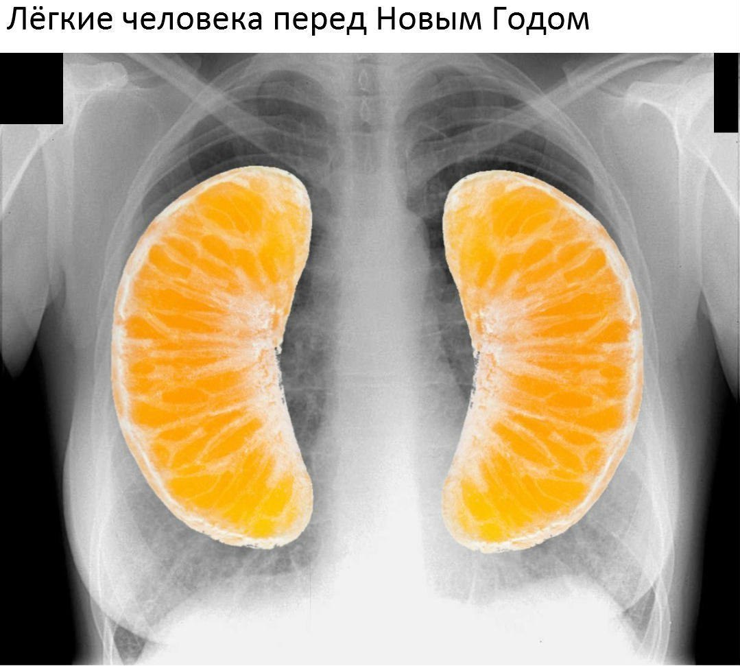 Лёгкие человека перед Новым Годом ги в