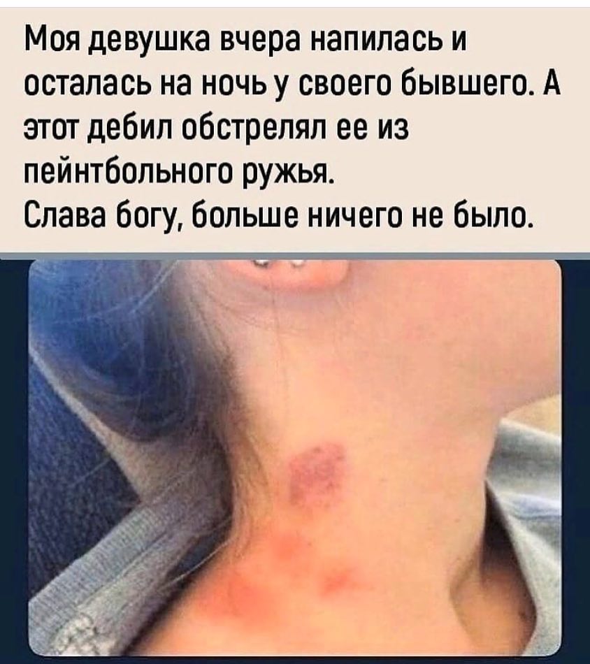 Моя девушка вчера напилась и осталась на ночь у своего бывшего А этот дебил обстрелял ее из пейнтбольного ружья Слава богу больше ничего не было