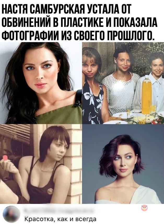 НАСТЯ САМЬУРСКАЯ УСТАЛА ОТ ВБВИНЕНИИ В ПЛАСТИКЕ И ПОКАЗАЛА Ф0Т0ГРАФИИ ИЗ СВВЕГВ ПРОШЛ0Г Красотка как и всегда
