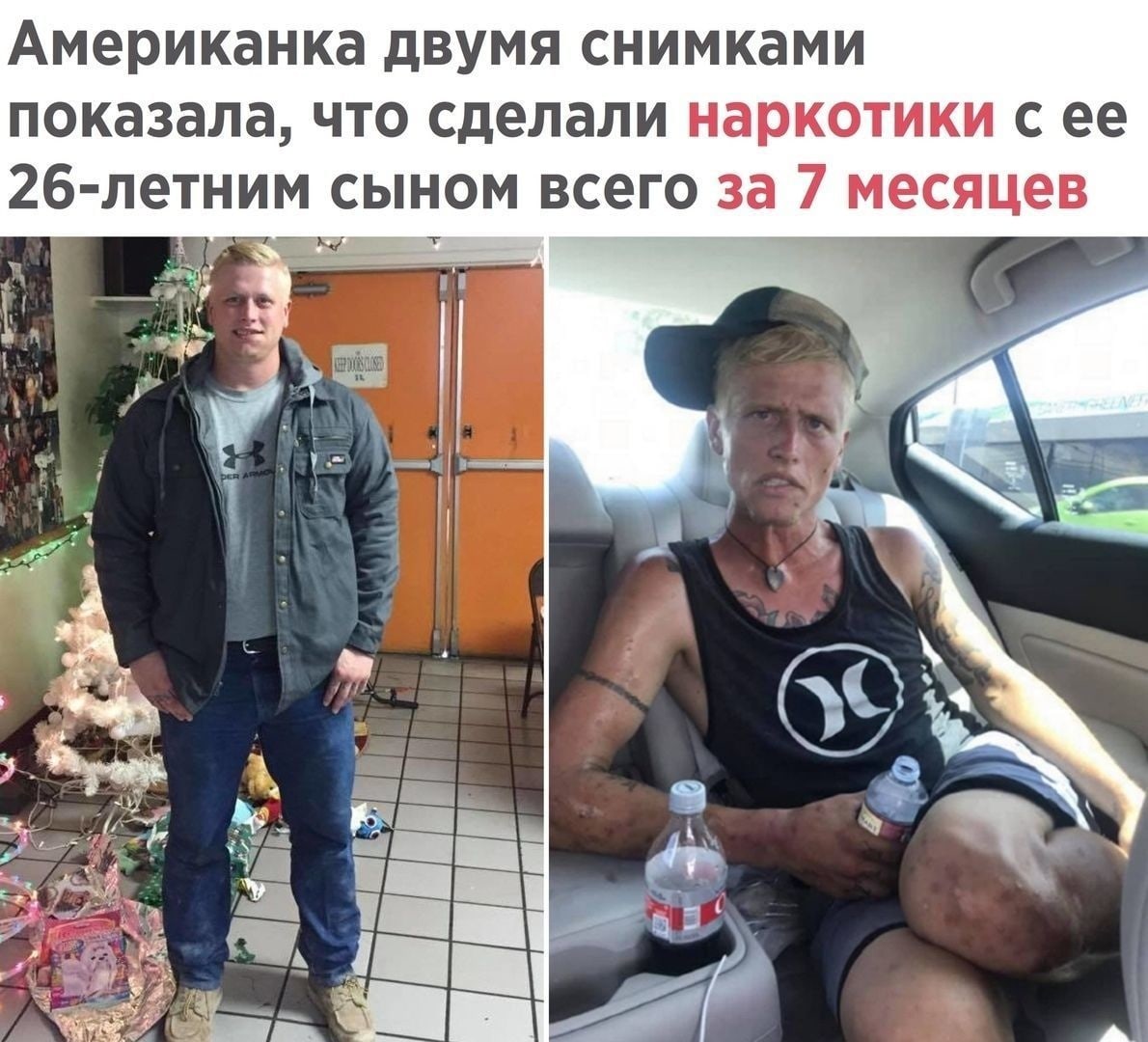 Американка ДВУМЯ СНИМКЭМИ показала ЧТО сделали НЗРКОТИКИ С ее 2