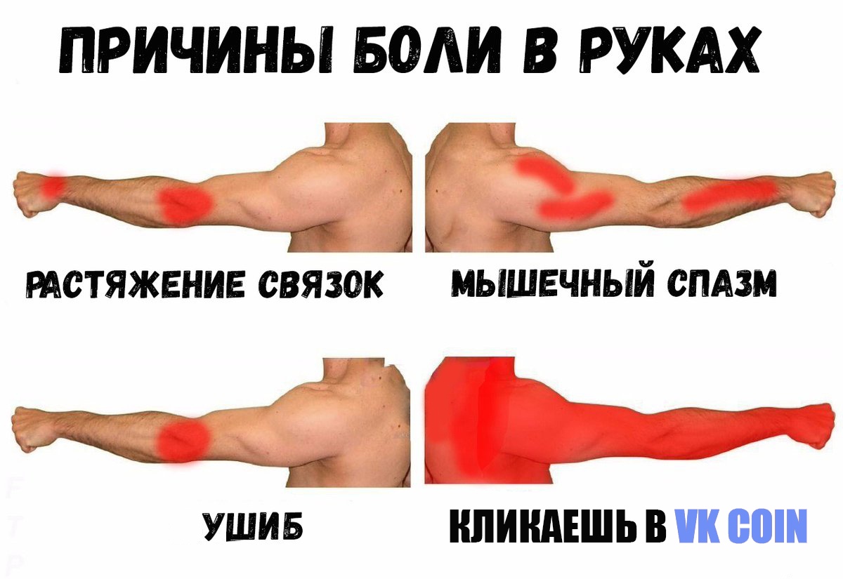 ПРИЧИНЫ БОЛИ В РУКАХ к А т Т РАСТЯЖЕНИЕ связок МЫШЕЧНЫИ СПАЗМ УШИБ НПИНДЕШЬ В ик 00