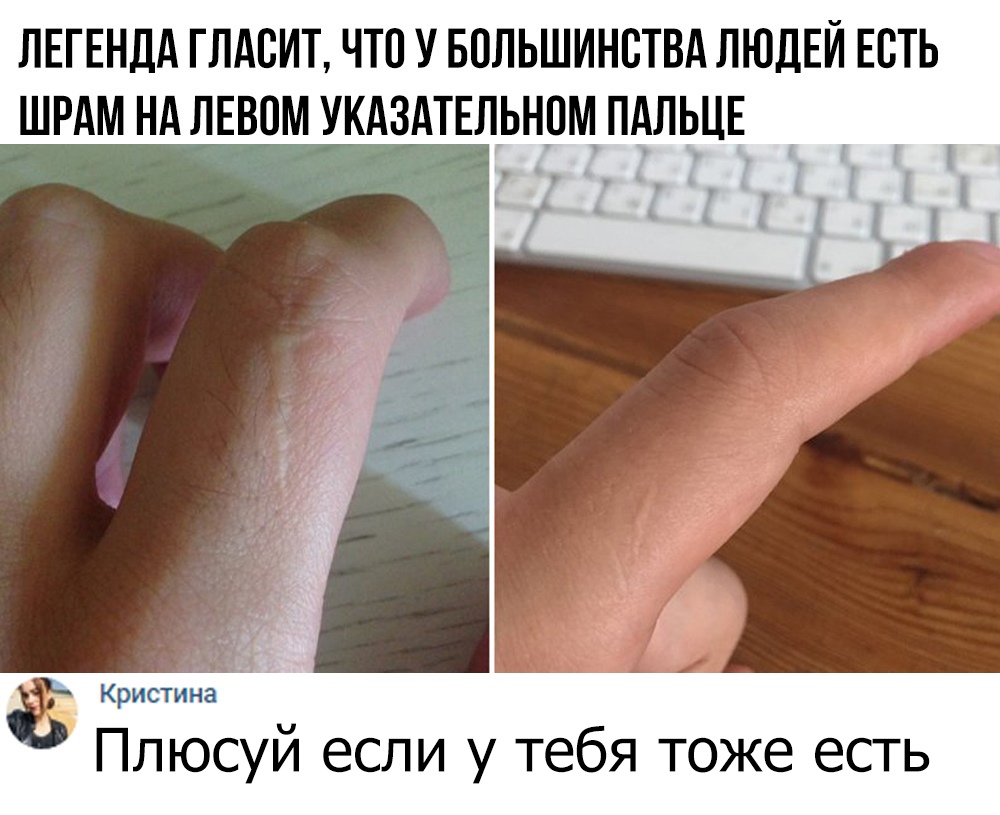ЛЕГЕНДА ГЛАВИТ ЧТО У БОЛЬШИНВТВА ЛЮДЕЙ ЕСТЬ ШРАМ НА ЛЕВВМ УКАЗАТЕЛЬНОМ ПАЛЬЦЕ д ё Кристина Ч Плюсуи если у тебя тоже есть