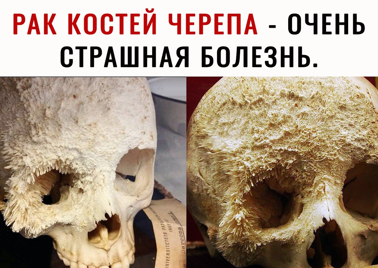 ОЧЕНЬ