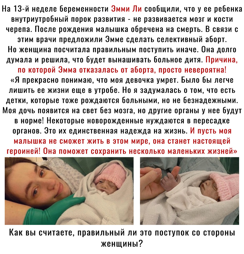 На 13 й неделе беременности сообщили что у ее ребенка внутриутроБный порок развития не развивается мозги кости черепа После рождения малышка обречена на смерть В связи с этим врачи предложили Эмме сделать селективный аборт Но женщина посчитала правильным поступить иначе Она долго думала и решила что Будет вынашивать больное дитя П Я прекрасно понимаю что моя девочка умрет Было Бы легче лишить ее ж