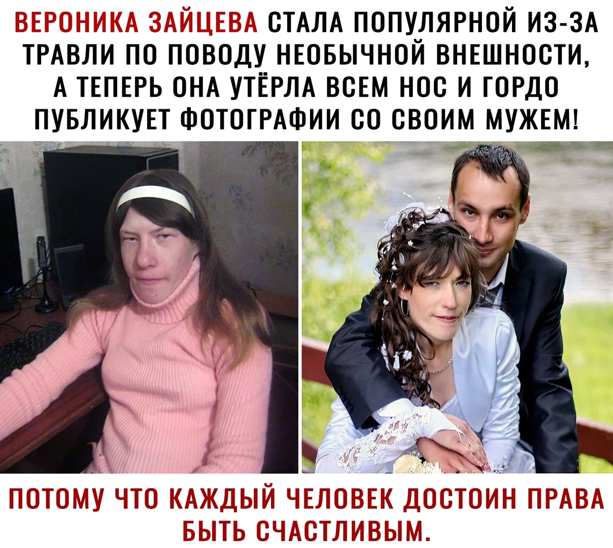 ОТАЛА ПОПУЛЯРНОЙ ИЗ ЗА ТРАВЛИ ПО ПОВОДУ_ НЕОБЫЧНОЙ ВНЕШНООТИ А ТЕПЕРЬ ОНА УТЁРЛА ВОЕМ НОО И ГОРДО ПУБЛИКУЕТ ФОТОГРАФИИ ОО СВОИМ МУЖЕМ