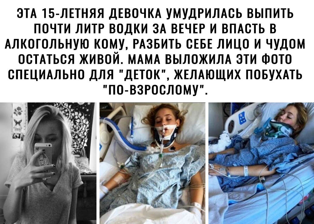 ЭТА 15 ЛЕТНЯЯ ДЕВОЧКА УМУДРИЛАСЬ ВЫПИТЬ ПОЧТИ ЛИТР ВОДКИ ЗА ВЕЧЕР И ВПАСТЬ В АЛКОГОЛЬНУЮ КОМУ РАЗБИТЬ СЕБЕ ЛИЦО И ЧУДОМ ОСТАТЬСЯ ЖИВОЙ МАМА ВЫЛОЖИЛА ЭТИ ФОТО СПЕЦИАЛЬНО ДЛЯ ДЕТОК ЖЕЛАЮЩИХ ПОБУХАТЬ ПО ВЗРОСЛОМУ _