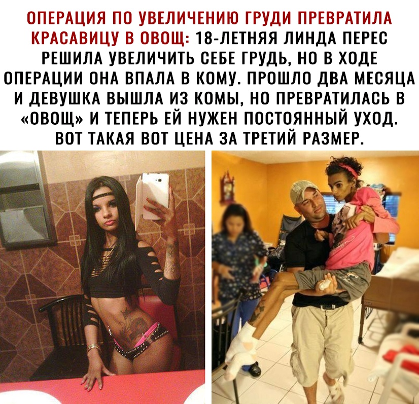 огпырдция по увыиичы пию груди ПРЕВРАТИЛА крдсдвицу в ВЮЩ18 ЛЕТНЯЯ ЛИНДА ПЕРЕс РЕШИЛА уввличить СЕБЕ ГРУДЬ но в ХОДЕ ОПЕРАЦИИ пнд ВПАЛА в кому прошло двд МЕСЯЦА и ДЕВУШКА ВЫШЛА из комы но ПРЕВРАТИЛАСЬ в ОВОЩ и ТЕПЕРЬ ЕЙ нужвн постоянный уход вот ТАКАЯ вот ЦЕНА зд ТРЕТИЙ РАЗМЕР