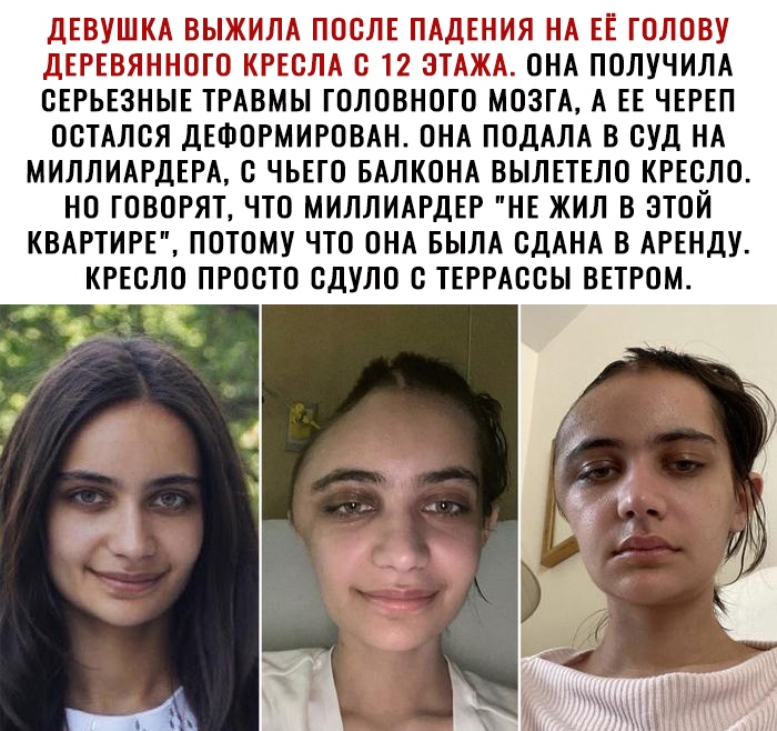 ДЕВУШКА ВЫЖИЛА ПОСЛЕ ПАДЕНИЯ НА ЕЕ ГОЛОВУ ДЕРЕВЯННОГО КРЕСЛА С 12 ЭТАЖА ОНА ПОЛУЧИЛА СЕРЬЕЗНЫЕ ТРАВМЫ ГОЛОВНОГО МОЗГА А ЕЕ ЧЕРЕП ОСТАЛСЯ ДЕФОРМИРОВАН ОНА ПОДАЛА В СУД НА МИЛЛИАРДЕРА С ЧЬЕГО БАЛКОНА ВЫЛЕТЕЛО КРЕСЛО НО ГОВОРЯТ ЧТО МИЛЛИАРДЕР НЕ ЖИЛ В ЭТОЙ КВАРТИРЕ ПОТОМУ ЧТО ОНА БЫЛА СДАНА В АРЕНДУ КРЕСЛО ПРОСТО СДУЛО С ТЕРРАССЫ ВЕТРОМ
