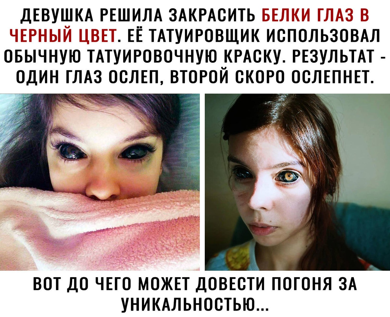 ДЕВУШКА РЕШИЛА ЗАКРАОИТЬ ЬЕ Ч П ЧЁ ГЧЪПР ТЕТ ЕЁ ТАТУИРОВЩИК ИСПОЛЬЗОВАЛ ОБЫЧНУЮ ТАТУИРОВОЧНУЮ КРАОКУ РЕЗУЛЬТАТ ОДИН ГЛАЗ ООЛЕП ВТОРОЙ ОКОРО ООЛЕПНЕТ ВОТ ДО ЧЕГО МОЖЕТ ДОВЕОТИ ПОГОНЯ ЗА УНИКАЛЬНООТЬЮ