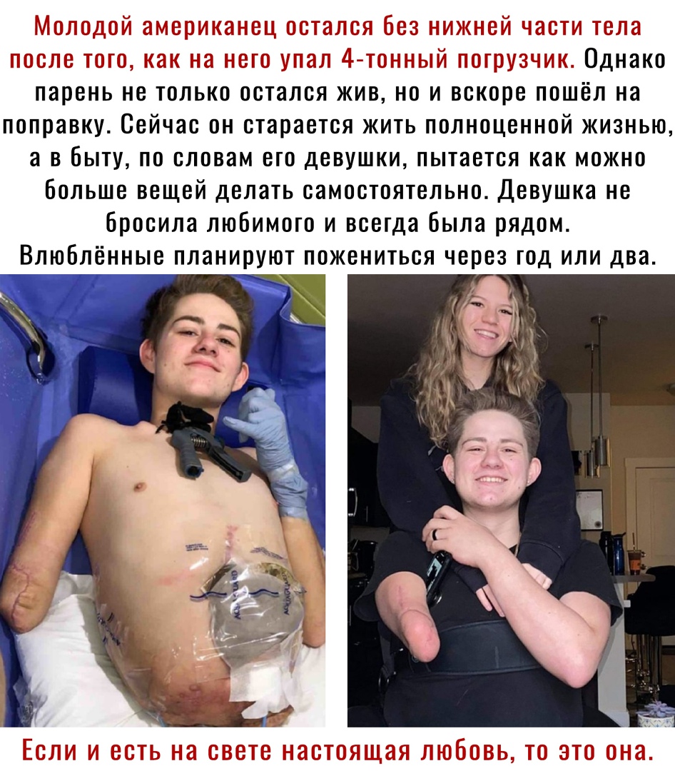 т н _ 14 Однако парень не только остался жив но и вскоре пошёл на поправку Сейчас он старается жить полноценной жизнью а в быту по словам его девушки пытается как можно больше вещей делать самостоятельно Девушка не бросила любимого и всегда Была рядом Влюблённые планируют пожениться через год или два П