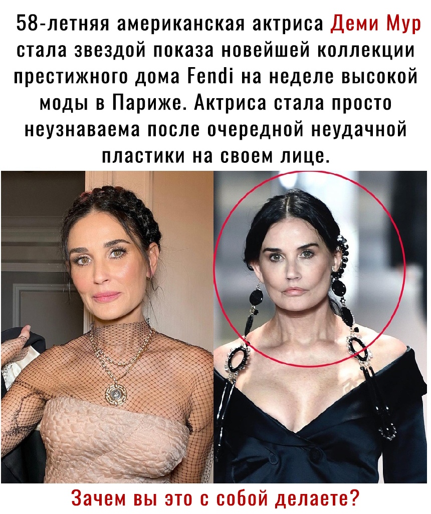58 летняя американская актриса т _ стала звездой показа новейшей коллекции престижного дома Гепоі на неделе высокой моды в Париже Актриса стала просто неузнаваема после очередной неудачной пластики на своем лице