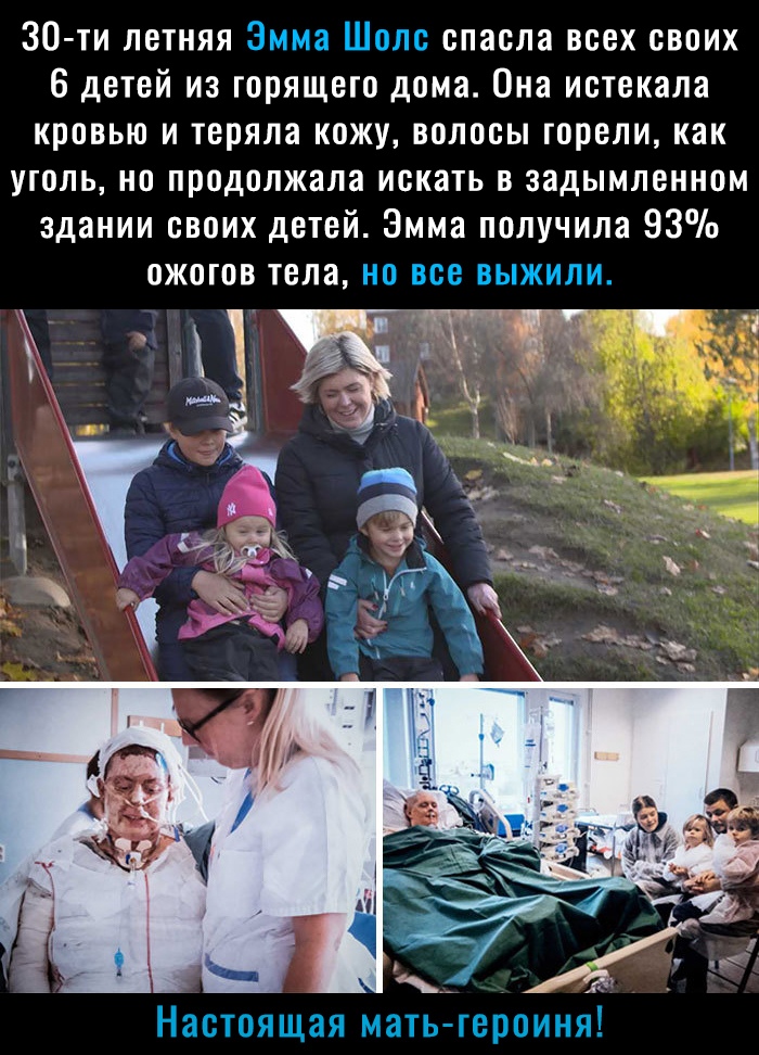 30 ти летняя Эмма Шолс спасла всех своих 6 детей из горящего дома Она истекала кровью и теряла кожу волосы горели как уголь но продолжала искать в задымленном здании своих детей Эмма получила 93 гі А Настоящая мать героиня
