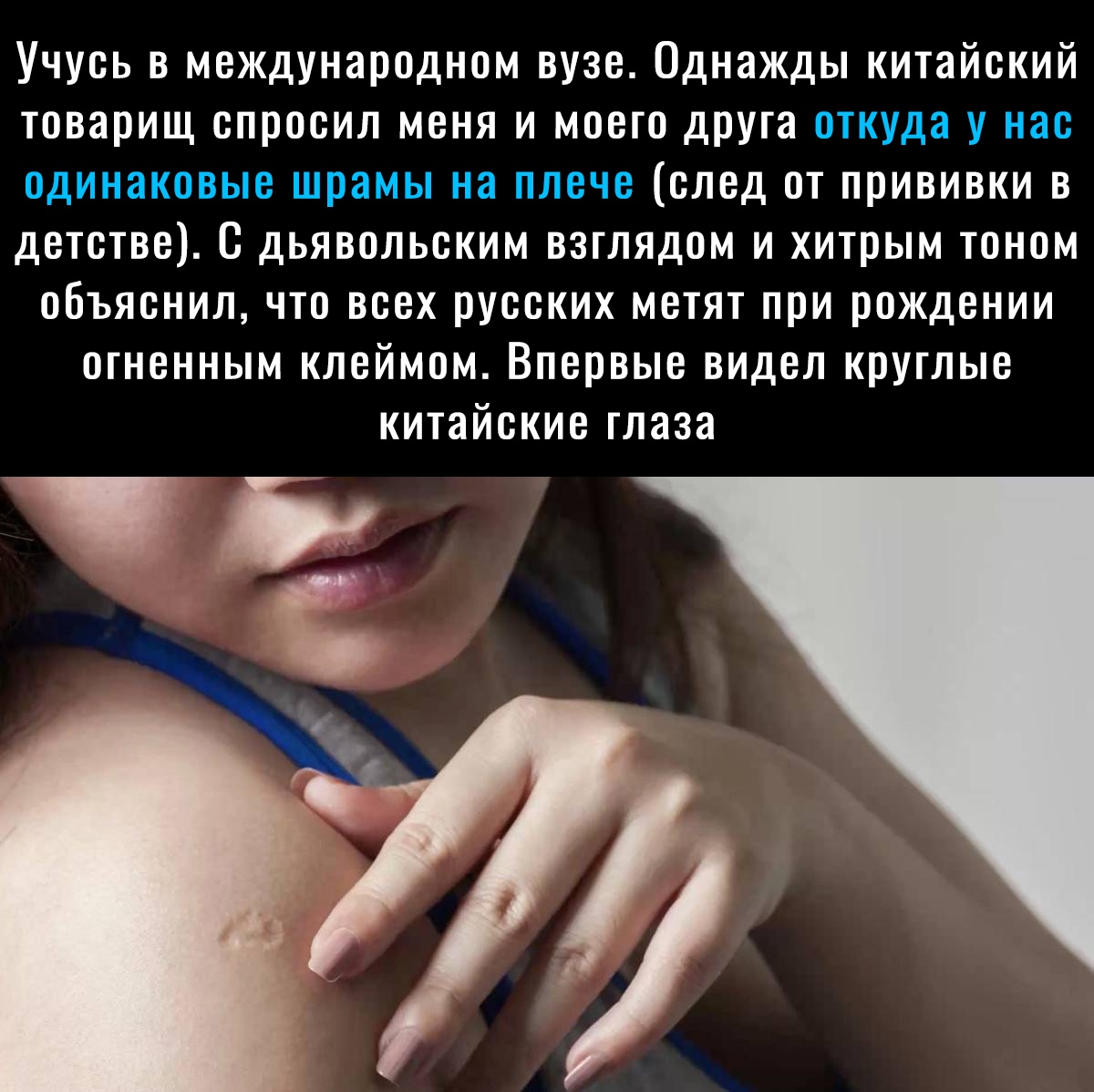 Учусь в международном вузе Однажды китайский товарищ спросил меня и моего друга откуда у нас одинаковые шрамьгна плечеслед отпрививки в детстве С дьявольским взглядом и хитрым тоном объяснилчтовсехруескихметятприрождении огненным клеймом Впервые видел круглые китайские глаза Тё _