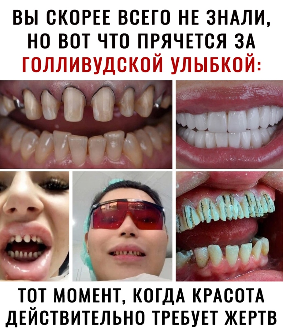 ВЫ СКОРЕЕ ВСЕГО НЕ ЗНАЛИ НО ВОТ ЧТО ПРЯЧЕТСЯ ЗА ТОЛЛИВУДСКОИ УЛЫБКОИ ТОТ МОМЕНТ КОГДА КРАСОТА ДЕИСТВИТЕЛЬНО ТРЕБУЕТ ЖЕРТВ