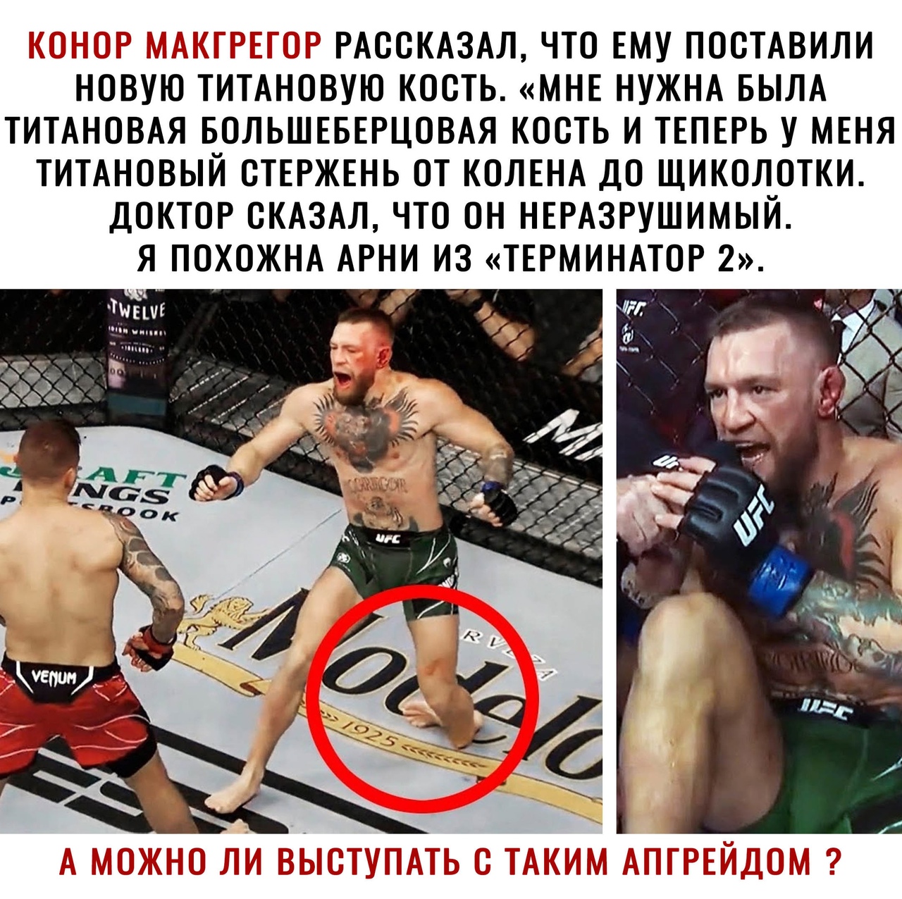Ё і Д __ _ РАООКАЗАЛ ЧТО ЕМУ ПООТАВИЛИ НОВУЮ ТИТАНОВУЮ КООТЬ МНЕ НУЖНА БЫЛА ТИТАНОВАЯ БОЛЬШЕБЕРЦОВАЯ КОСТЬ И ТЕПЕРЬ У МЕНЯ ТИТАНОВЫЙ ОТЕРЖЕНЬ ОТ КОЛЕНА ДО ЩИКОЛОТКИ ДОКТОР СКАЗАЛ ЧТО ОН НЕРАЗРУШИМЫЙ Я ПОХОЖНА АРНИ ИЗ ТЕРМИНАТОР 2 ТыЕ О г