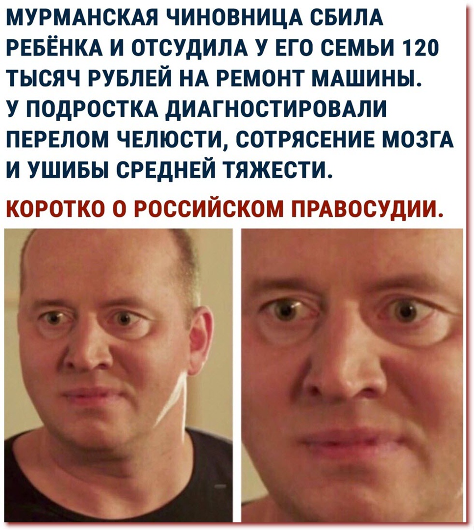 МУРМАНСКАЯ ЧИНОВНИЦА СБИЛА РЕБЁНКА И ОТСУДИЛА У ЕГО СЕМЬИ 120 ТЫСЯЧ РУБЛЕЙ НА РЕМОНТ МАШИНЫ У ПОДРОСТКА дИАГНОСТИРОВАЛИ ПЕРЕЛОМ ЧЕЛЮСТИ СОТРЯСЕНИЕ МОЗГА И УШИБЫ СРЕДНЕЙ ТЯЖЕСТИ КОРОТКО О РОССИЙСКОМ ПРАВОСУДИИ