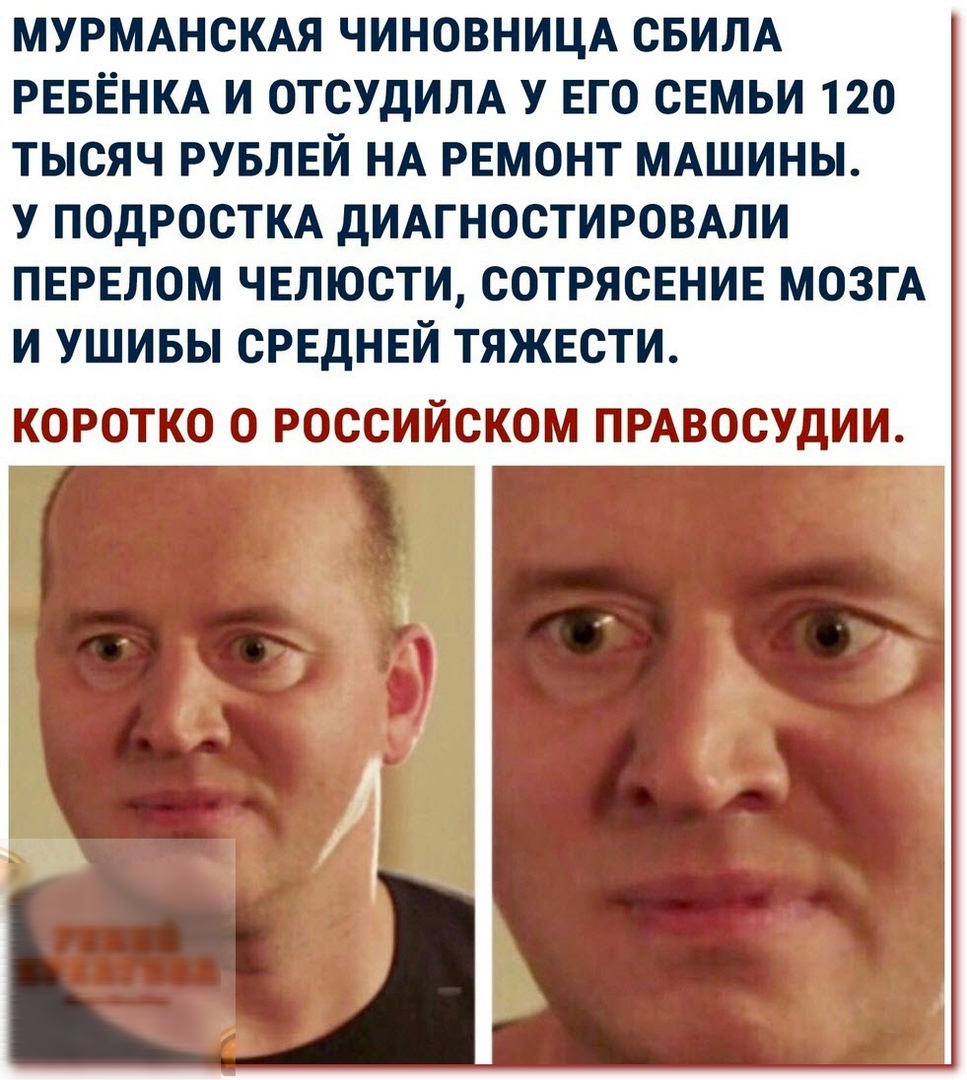 МУРМАНСКАЯ ЧИНОВНИЦА СБИЛА РЕБЁНКА И ОТСУДИЛА У ЕГО СЕМЬИ 120 ТЫСЯЧ РУБЛЕЙ НА РЕМОНТ МАШИНЫ У ПОДРОСТКА дИАГНОСТИРОВАЛИ ПЕРЕЛОМ ЧЕЛЮСТИ СОТРЯСЕНИЕ МОЗГА И УШИБЫ СРЕДНЕЙ ТЯЖЕСТИ КОРОТКО О РОССИЙСКОМ ПРАВОСУДИИ