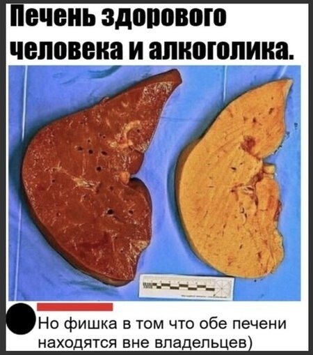 ечень ЗДОВОВФШ человека И апноюпииа Но фишка в том что обе печени находятся вне владельцев